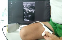 „Europos horizontas“ projekte „ThrombUS+“ vykdomi klinikiniai tyrimai