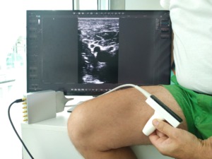 ThrombUS+ projekte vykdomi klinikiniai tyrimai